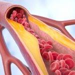 colesterol-ldl-por-qué-debemos-controlarlo