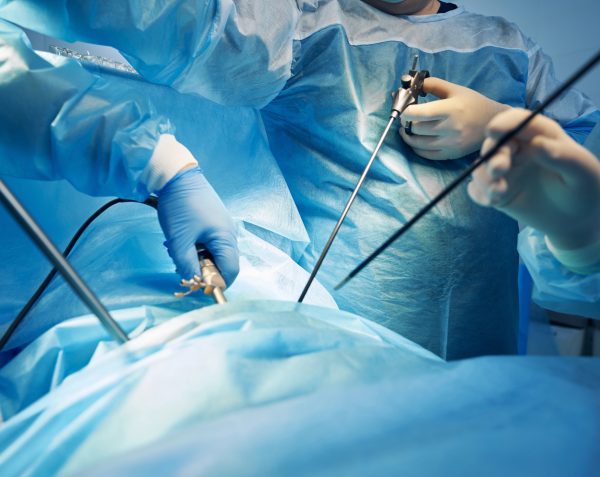 Laparoscopia: qué es y cómo funciona esta cirugía