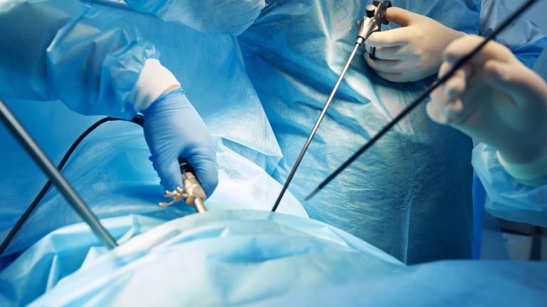 Laparoscopia: qué es y cómo funciona esta cirugía
