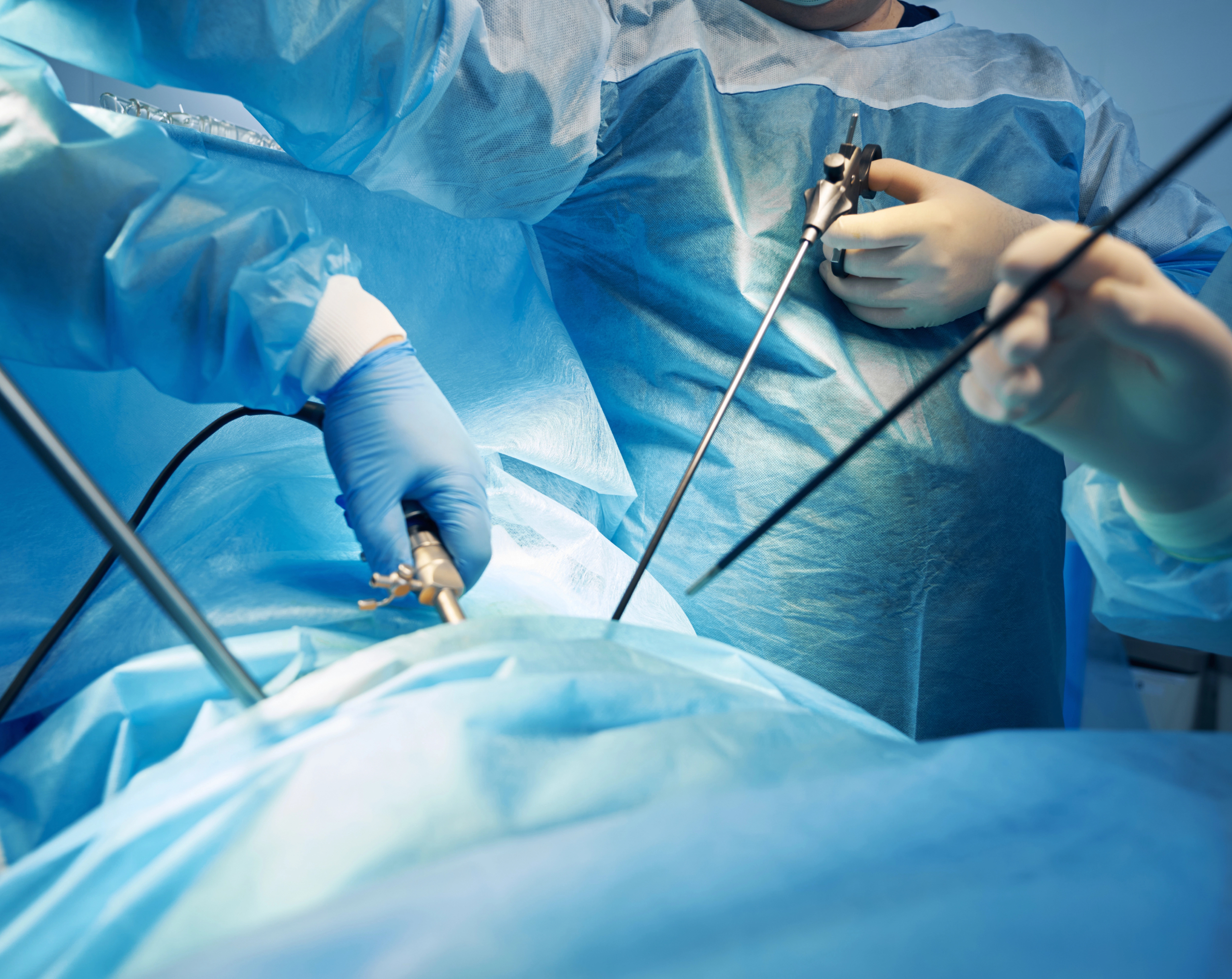 doctor haciendo una laparoscopia