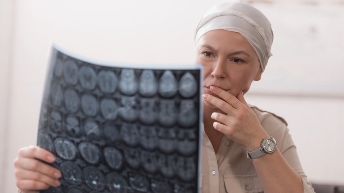 Qué-es-el-cáncer-de-cabeza-y-cuello