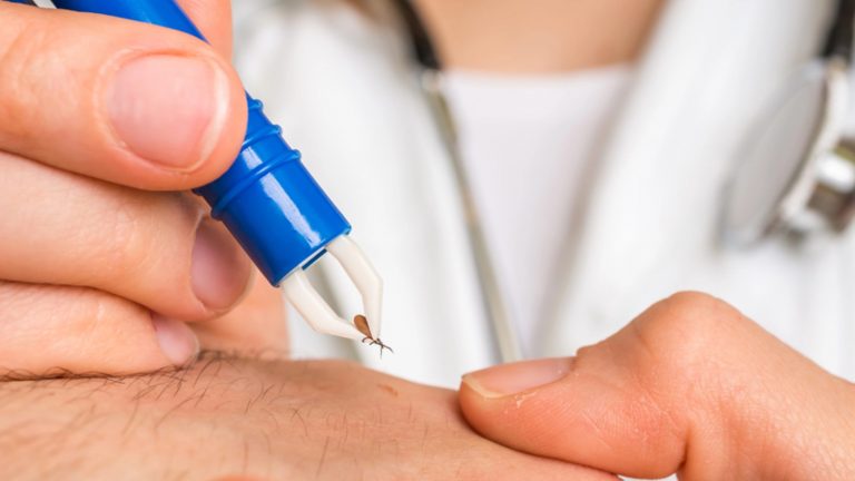 Enfermedad de Lyme | ¿Puede ser mortal?