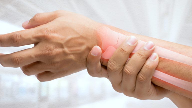 Osteoporosis | Señales tempranas en adultos