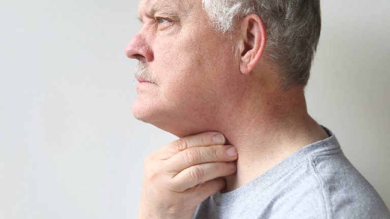 Cáncer de garganta | Sus inicios y tratamiento
