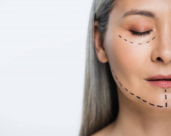 Lifting facial: ¿Qué es y en qué consiste?