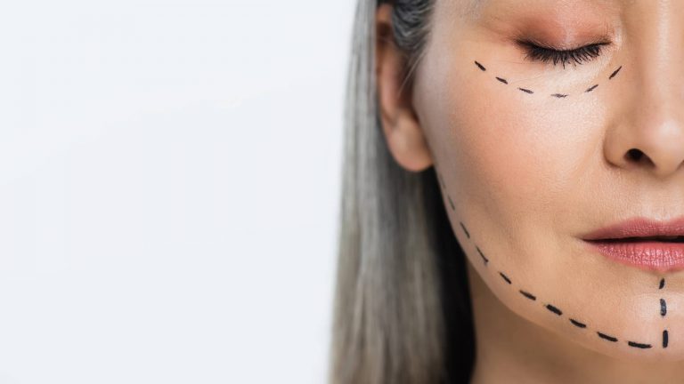 Lifting facial: ¿Qué es y en qué consiste?
