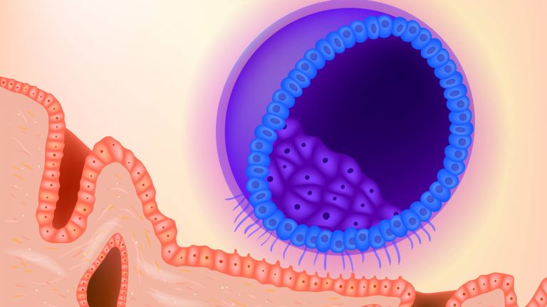 Sangrado de implantación | ¿Indicio de embarazo?