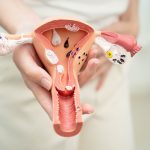 Mujer con dolor abdominal sostiene una estructura anatómica del útero que incluye el tejido del cuello uterino donde tiene lugar la cervicitis.