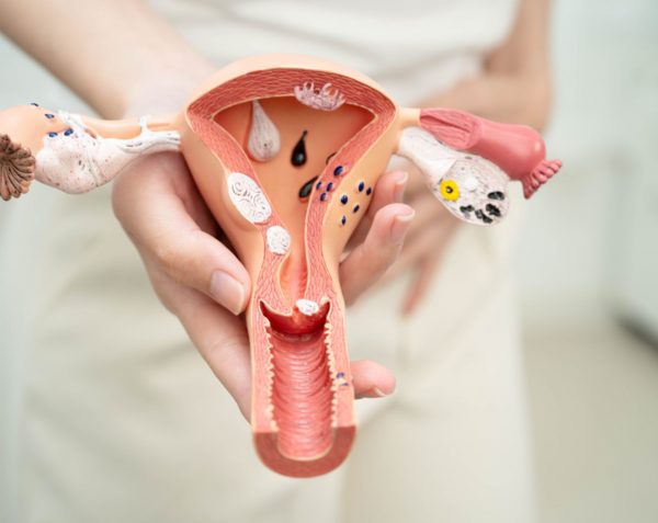 ¿Qué es la cervicitis? Causas y síntomas