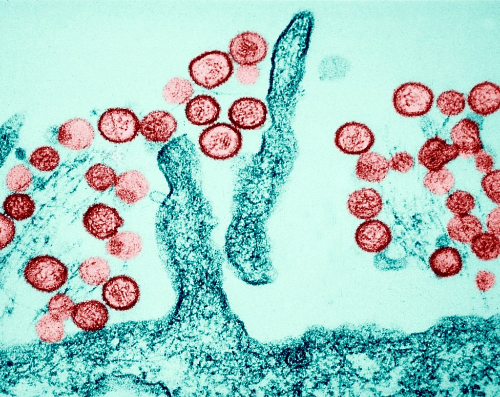 El Hantavirus visto desde un microscopio, un virus que está propagándose entre humanos actualmente.