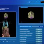 aisha-mri-la-resonancia-magnetica-del-futuro