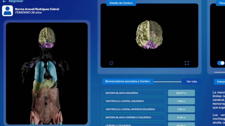 AISHA MRI: La resonancia magnética del futuro