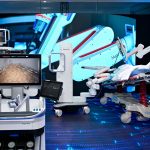 Exhibición del robot quirúrgico Hugo RAS para médicos en el Hospital Angeles Acoxpa.