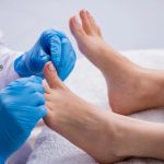 Médico especializado revisando los pies de un paciente debido a molestias de uña enterrada.