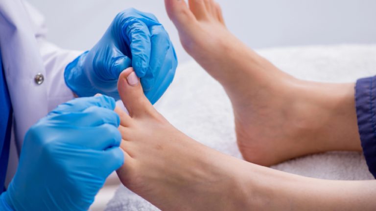 Uñas enterradas | Causas y tratamiento