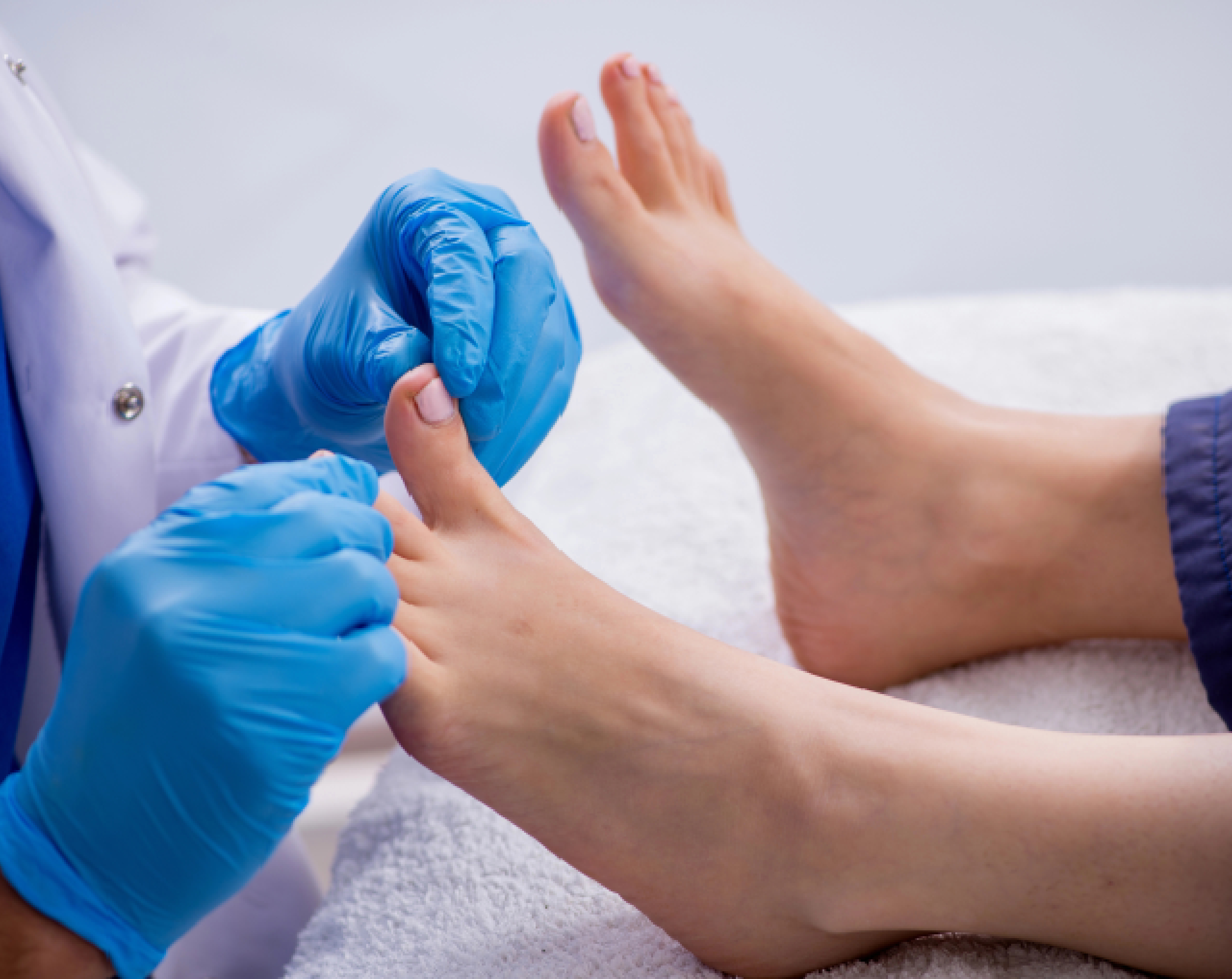 Médico especializado revisando los pies de un paciente debido a molestias de uña enterrada.