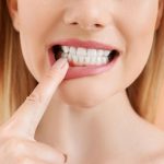 Mujer de mediana edad toca con el dedo índice sus encías inflamadas a causa de un absceso dental, mostrando hinchazón y molestia en la zona bucal