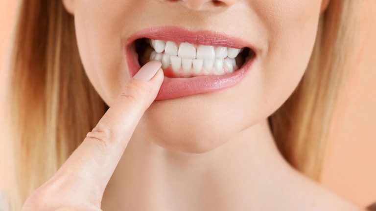 Absceso dental | Causas y síntomas