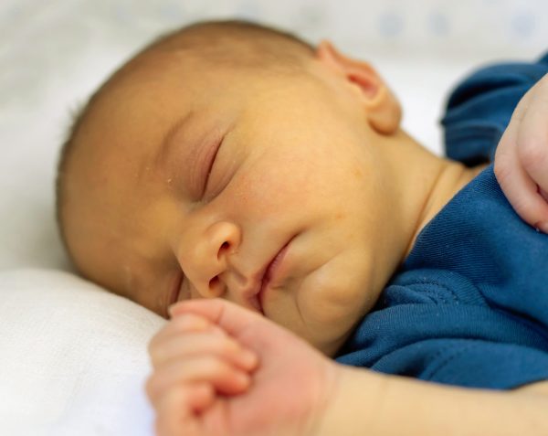 Ictericia en bebés | Causas y cuidados