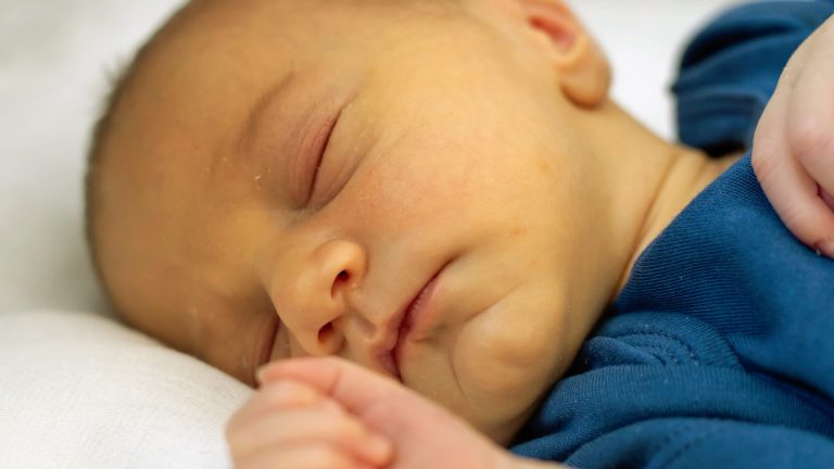 Ictericia en bebés | Causas y cuidados