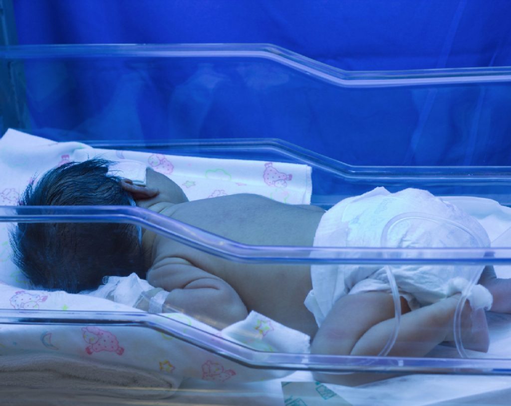 Bebé recién nacido duerme boca abajo usando sólo un pañal en la unidad de fototerapia para tratar la ictericia. 