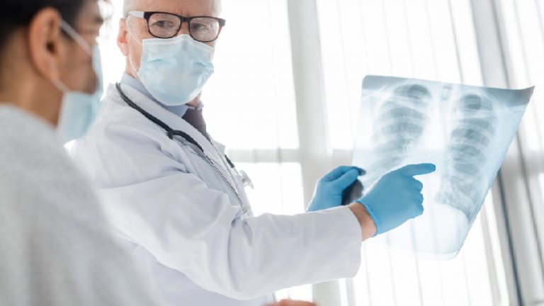 Lobectomía | Definición, riesgos y beneficios