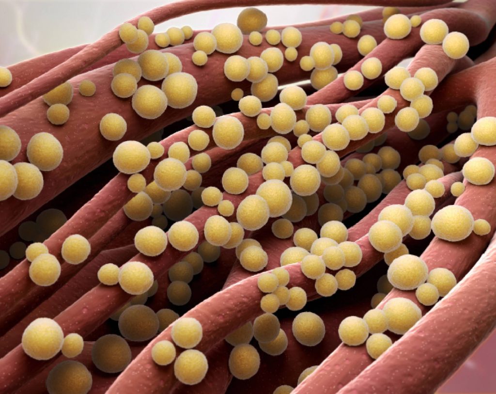 Ilustración 3D de la bacteria Staphylococcus aureus, la cual puede provocar graves infecciones.