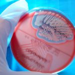Científico toma con guantes una muestra de Staphylococcus aureus en una placa de Petri.