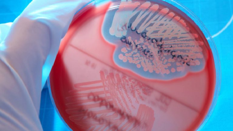 Staphylococcus aureus | ¿Qué es?