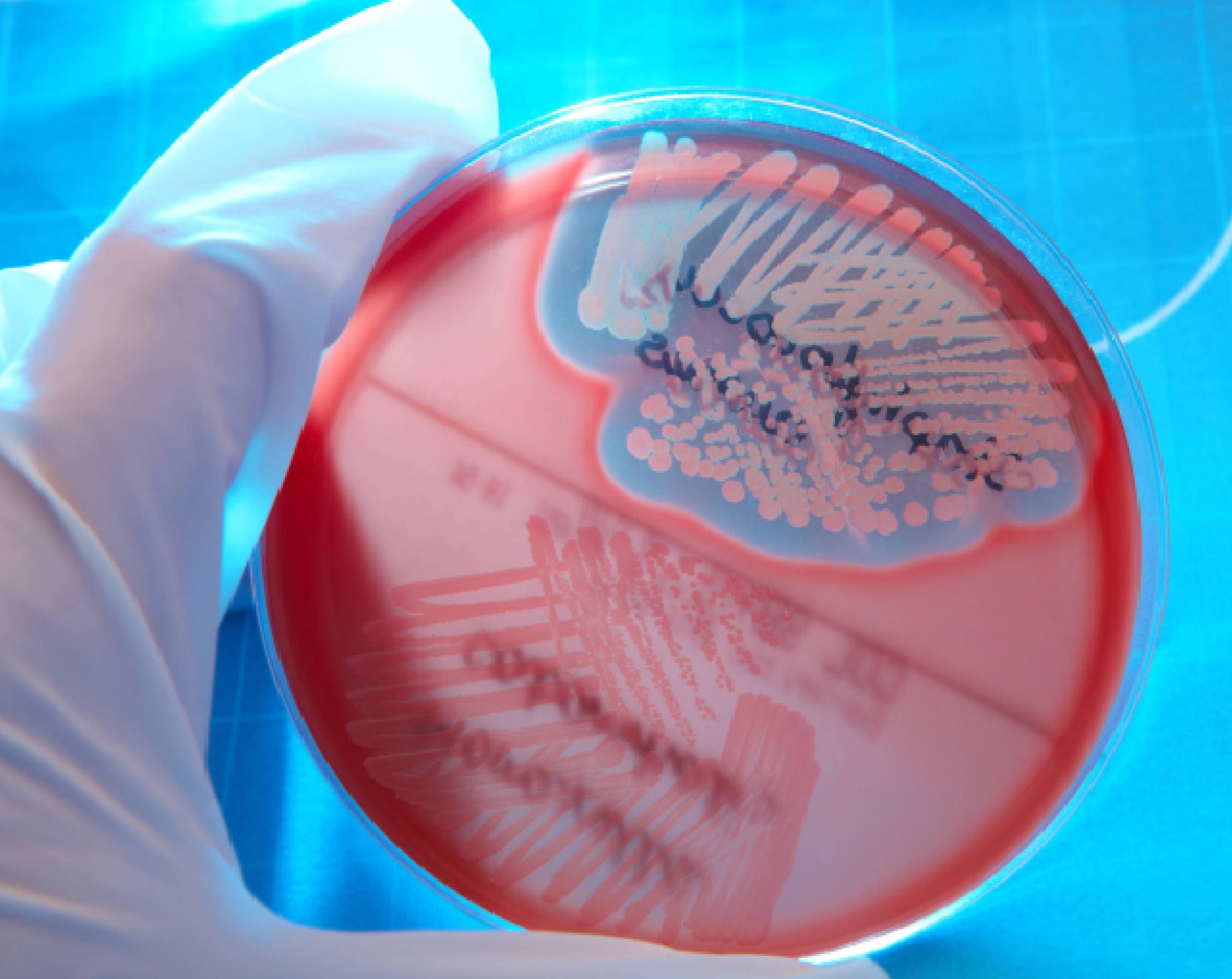 Científico toma con guantes una muestra de Staphylococcus aureus en una placa de Petri.