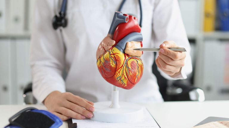 Stent coronario | ¿Qué es y cuándo es recomendado?