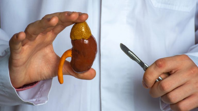 Nefrectomía | ¿Qué es y cuáles son sus riesgos?