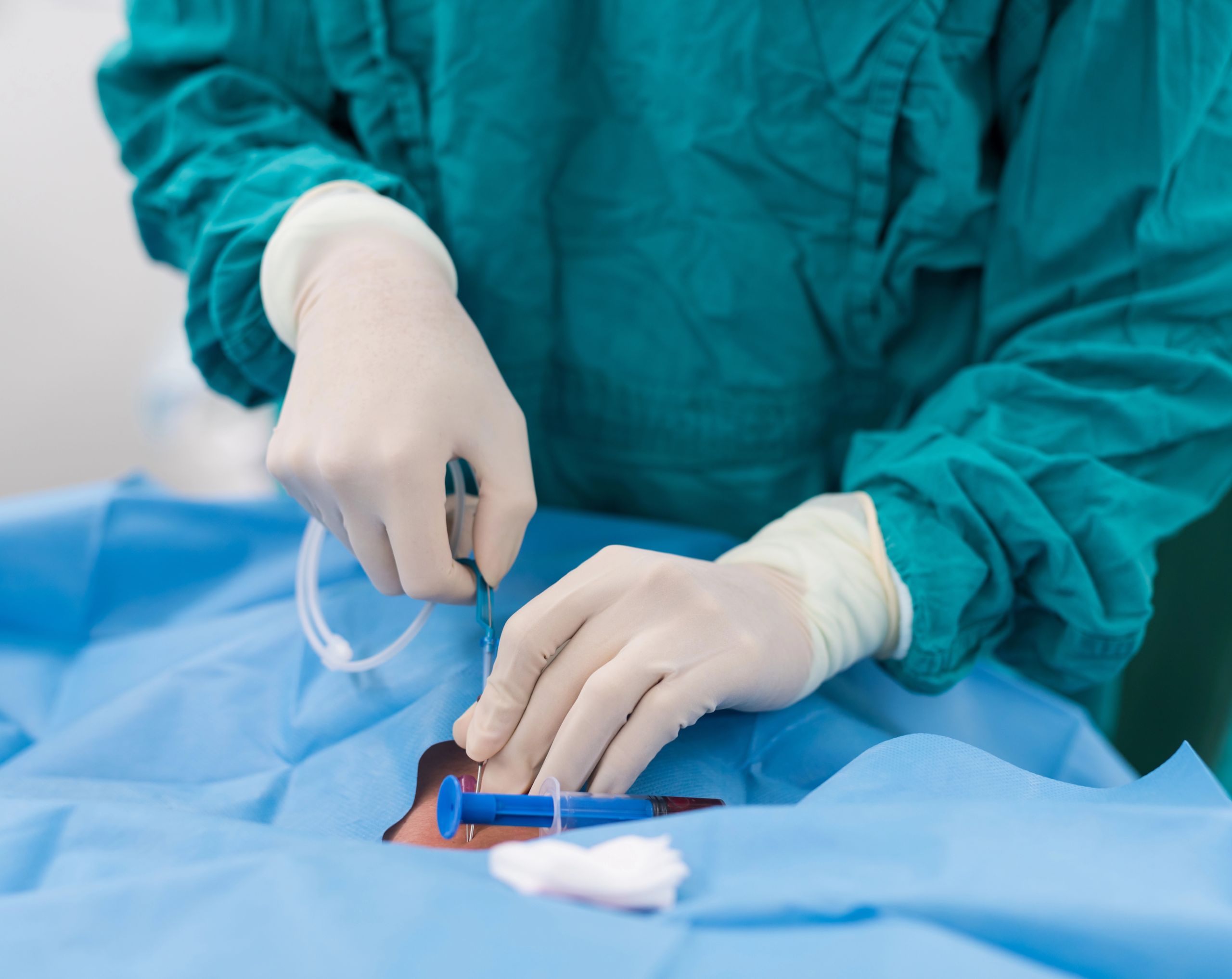 Cardiólogo del Hospital Angeles coloca un stent coronario durante un procedimiento de angioplastia guiado por catéter.