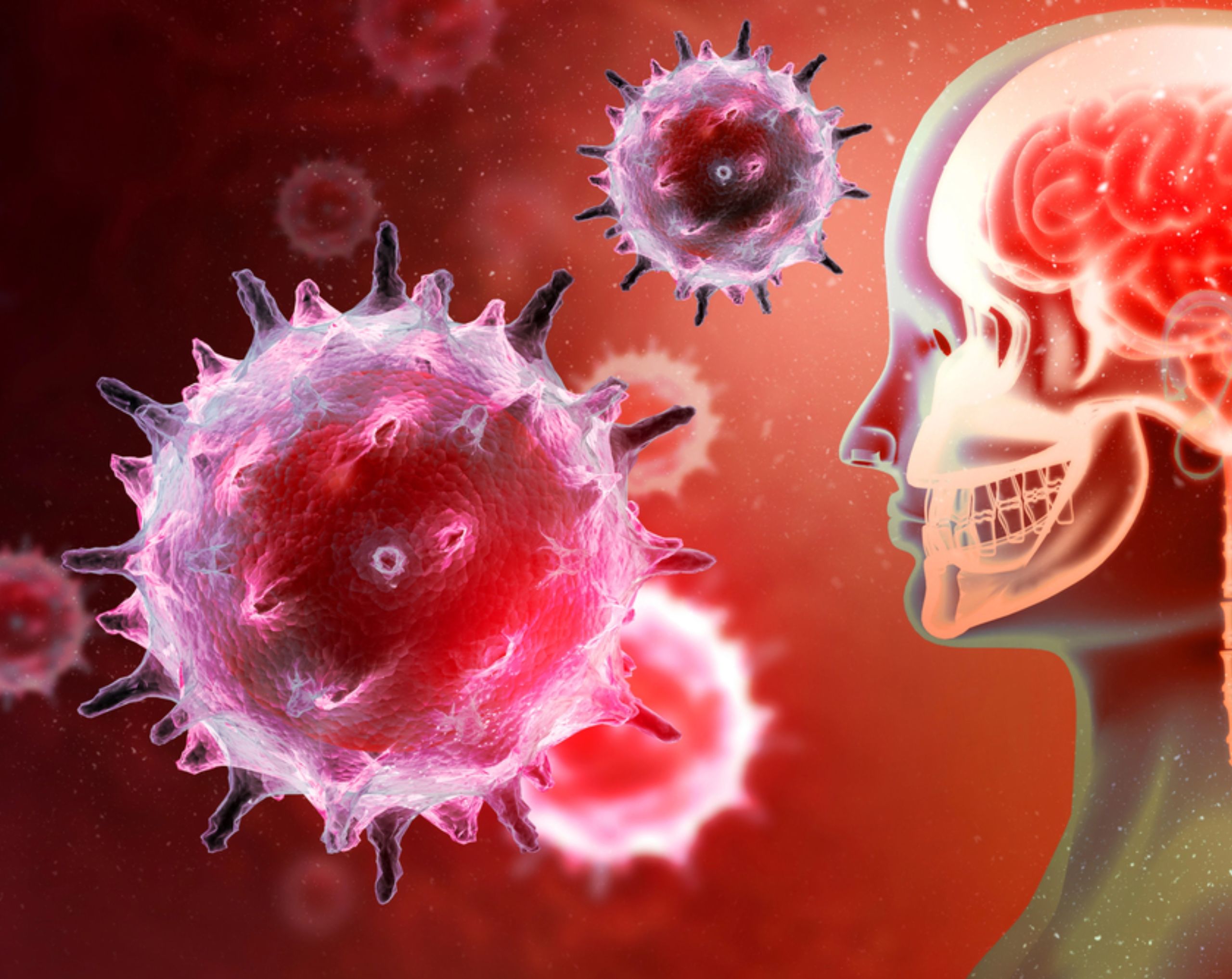 Modelos 3D de virus y bacterias dirigiéndose al cerebro humano, representación de las causas de la meningitis.