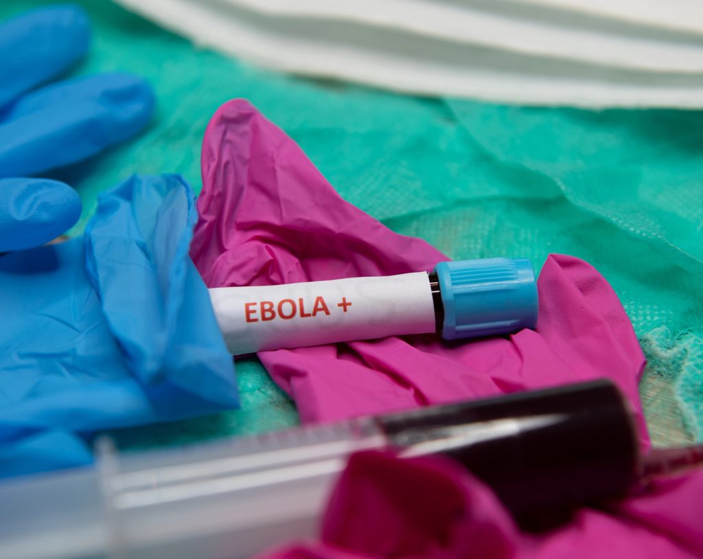 Fotografía de tubo de ensayo con muestra de sangre de un paciente que ha dado positivo al virus del ébola.